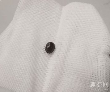 蜱虫咬人后有什么症潮牌汇潮牌网状 蜱虫会钻进人的身体吗（蜱虫咬人后有什么症状 蜱虫会钻进人的身体吗）