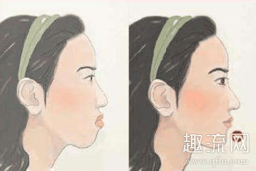 嘴巴突出太丑怎么办 拯救潮牌信息凸嘴呼吸大法矫正凸嘴小毛病（嘴巴突出太丑怎么办 拯救凸嘴呼吸大法矫正凸嘴小毛病）