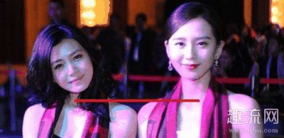 脖子短的人适合什么领的潮牌商城衣服 脖子短是什么原因 怎么变长（脖子短的人适合什么领的衣服 脖子短是什么原因 怎么变长）