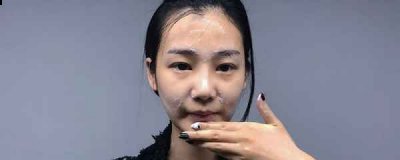 刷酸对于很多人来说虽然很常见 2022秋冬潮牌新款推荐（水杨酸棉片刷酸步骤 这样还学不会就太没天理了 ）