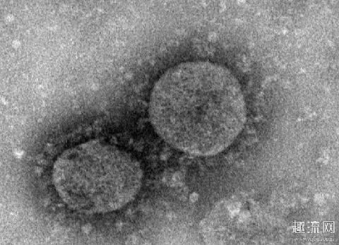 新型冠状病毒突变会怎么样 新型冠状病毒突变丧失听力味觉是真的吗